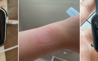 部分Apple Watch SE存在过热现象 新系统修复三代手表重启问题